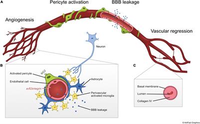 Microvascular Changes in Parkinson’s Disease- Focus on the Neurovascular Unit